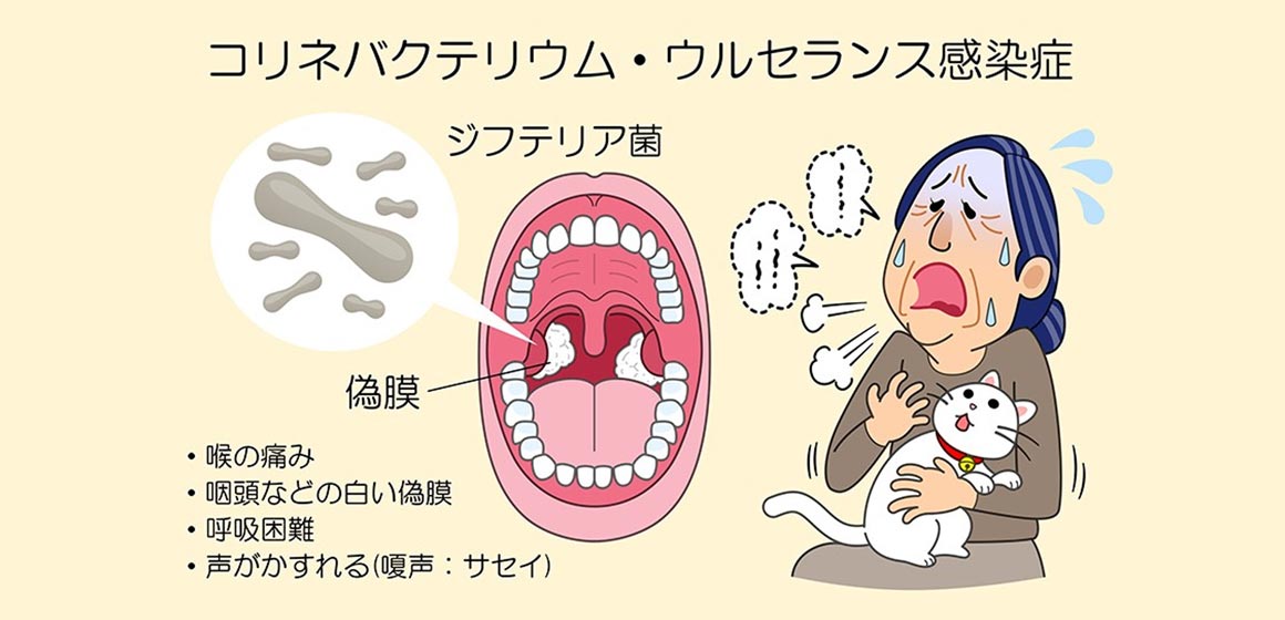 コリネバクテリウム・ウルセランス感染症：喉の痛み。咽頭などの白い偽膜。呼吸困難。声がかすれる（嗄声：サセイ）。