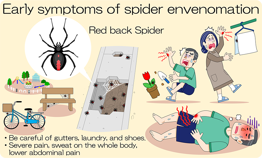 Initial symptoms of venomous spiders：Be careful in gutters, laundry, and shoes. Severe pain, generalized greasy sweats, lower abdominal pain.