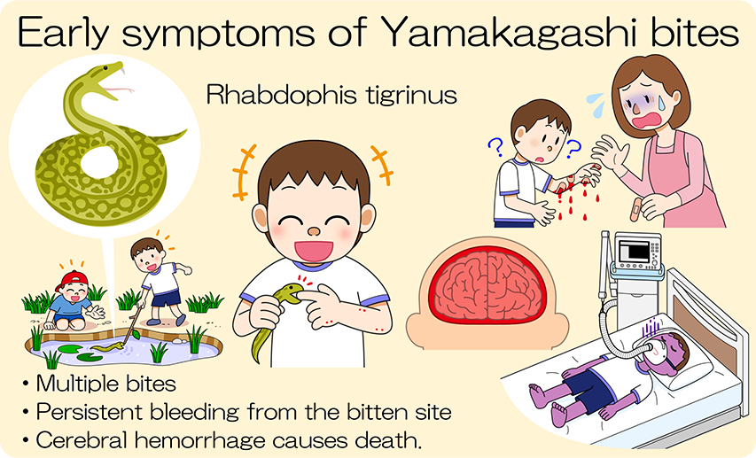 Initial symptoms of venomous snakes：Repeatedly bitten. Bites continue for a long time. Bites continue to bleed for a long time. If cerebral hemorrhage occurs, death may result.